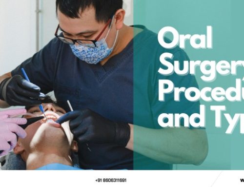 Oral Surgery: Procedure, types& Definitions